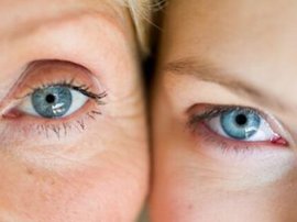 Генетика, наследственность, фото, заболевание