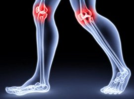 суставы, коленный сустав, тазобежренный сустав, лечение суставов, артроз суставов, боль в суставах. плечевой сустав, болят суставы. локтевой сустав, артроз коленного сустава, лечение коленного сустава, суставы рук, суставы ног