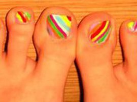 грибок ногтей, онихомикоз, грибка, лечением грибка, грибка ногтей, виды грибков, виды грибков ногтей, избавиться от, избавиться от грибка ногтей 