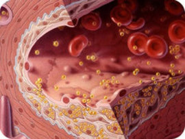 холестерин, что такое холестерин, уровень холестерина, нормальным, сахарным диабетом, сердца, атерогенного холестерина, нужен холестерин, ишемической болезнью сердца, артериальной гипертензией, атеросклерозом, лишнего веса, климакса