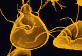 Лямблиоз, или Как избавиться от простейших? Лечение и профилактика