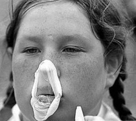 жевательная резинка, вред, зубы