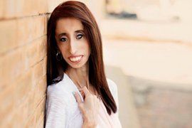 лиззи веласкес, красота, уродливость, анрексия