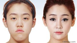 имплант, протез, стоматология, зубы, лечение зубов, хирургия, красивые зубы, прикус