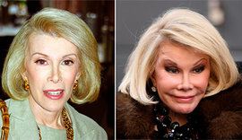 Звездные неудачи, или Ошибки пластических хирургов