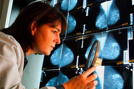 Онкологи нашли причину, из-за которой лечение рака бесполезно