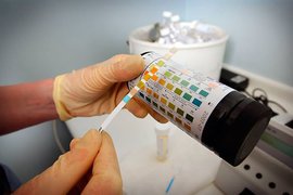 сахарный диабет