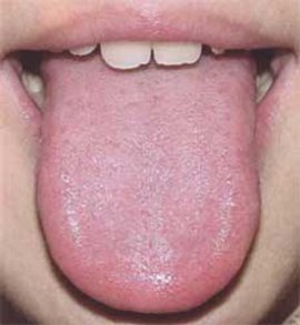 горло, язык, избавиться от, простуды, профилактика, йога, ноги, дыхательных, миндалины, заболевания, болезни, лечить простуду, боль в горле, поза льва, профилактика, простудных, воспаление легких