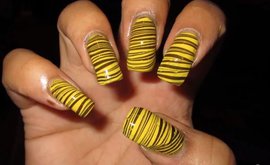 лечение, полосатые ногти, грибок, онихомикоз 