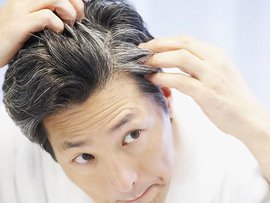 Как справиться с перхотью?