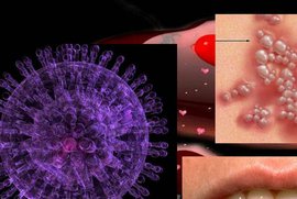 дерматология