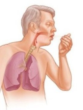 бронхит, кашель, пневмония, лечение бронхита, воспаление легких