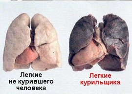 диагноз, рак легких, диагноз рак легких, заболеть раком легких, кто чаще более раком легких, симптомы рака легких, признаками  рака легких, лечение рака легких, прогноз при диагнозе рак легких