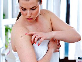 родинка, сексуальность, родинке на лице, родинку на шее, размер родинок, перерождения родинок, много родинок на теле, признаки, как лечить родинки, удалить, удалять ли родинку, удалить родинку