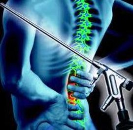 спинальная хирургия, малоинвазивная хирургия, хирургии позвоночника, лечения позвоночника, травмы позвоночника, лечении травм позвоночника, малоинвазивных операциях, лечения компрессионных переломов позвоночника, патологии позвоночника