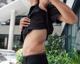 хирург, трансплантация, почка, донор, органы