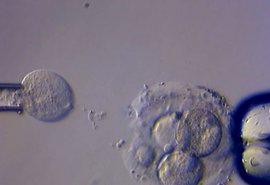 Брат спас сестру от смертельного наследственного заболевания