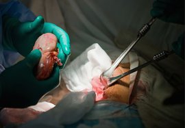 трансплантология