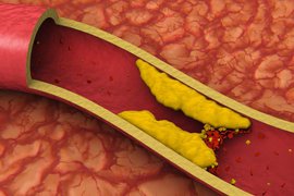 холестерин